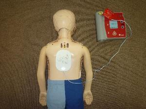 写真：AEDを貼る位置（背面）