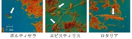 微生物の写真 ボルティセラ・エピスティリス・ロタリア
